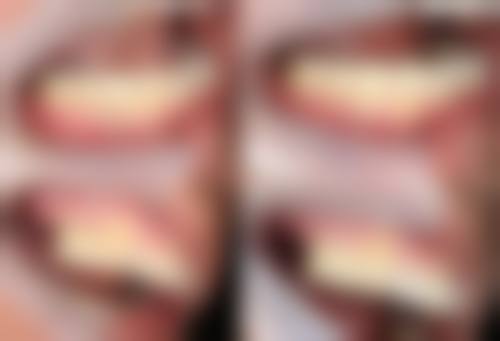 六、西安碑林齐贝口腔诊所口碑如何？