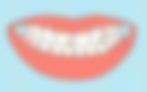 隐形牙齿矫正需要多长时间？受配合程度影响