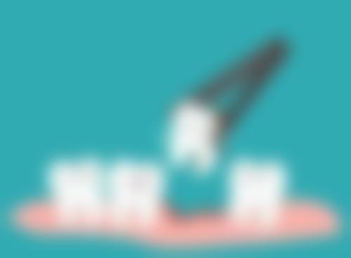 纠正牙齿拔牙到底好不好？需结合个体情况判断