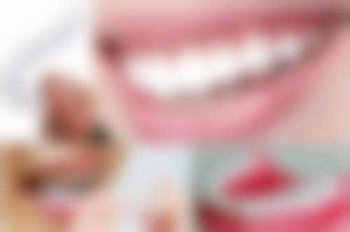 纠正牙齿拔牙到底好不好？拔牙可能存在的弊端