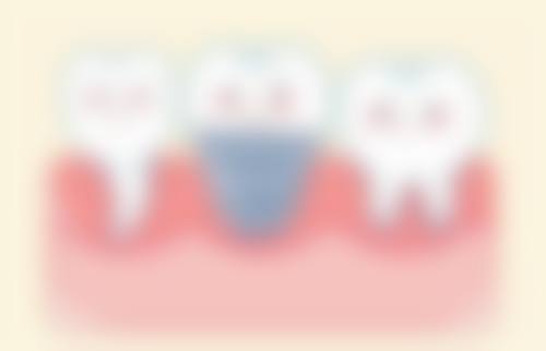 四、东莞芽豆口腔特色项目