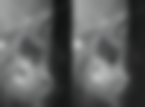 五、西安碑林齐贝高勇医生技术怎么样？