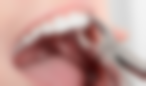 六、内蒙古包头凯美康口腔口碑如何？