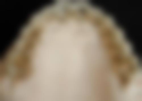 八、绍兴市上虞人民医院口腔科怎么预约？