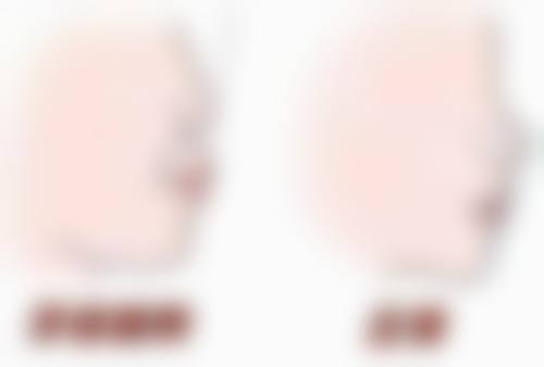 洗牙后可以用盐水漱口吗？立即漱口有讲究