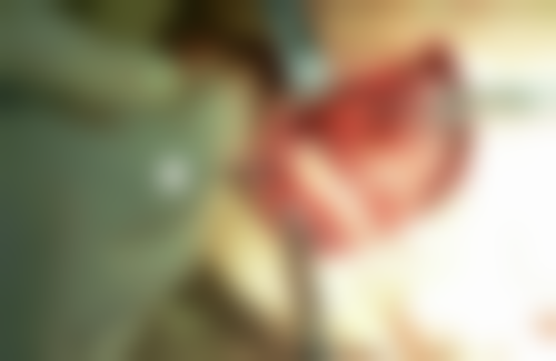 五、东莞石龙微笑口腔收费价格表