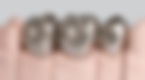 洗牙后可以用盐水漱口吗？多位医生建议，洗牙后不同时段用盐水漱口有不同讲究！ 