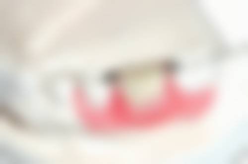 备孕时候拔牙有没有影响？特殊情况可能有潜在干扰