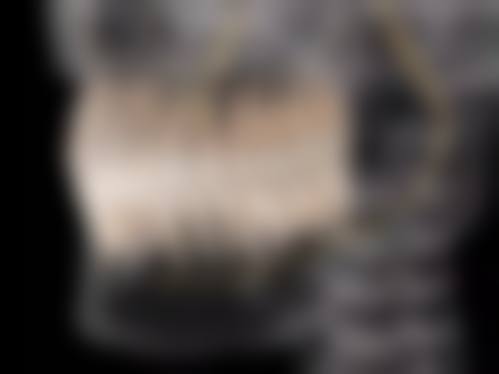 六、广州冠华口腔(华景总院)口碑如何？