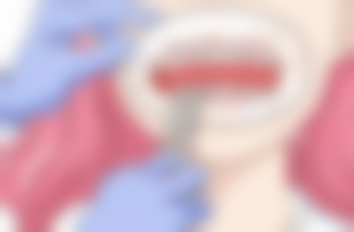 钴铬烤瓷牙和镍铬烤瓷牙哪个贵？钴铬烤瓷牙更贵，因其工艺复杂、成分要求高，价格在600 - 3000元/颗！ 