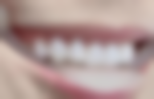 四、淮安青植植发诊所特色项目