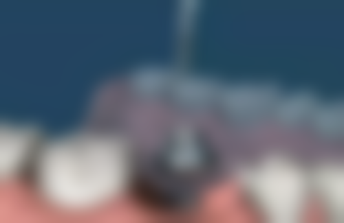 四、厦门力锜•祥富口腔(中海福林店)特色项目