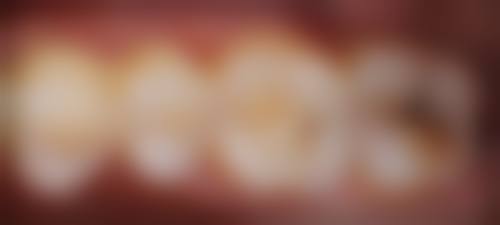 四、宿迁张雷口腔特色项目