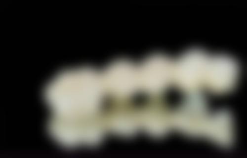 五、广东中山骑士口腔收费价格表