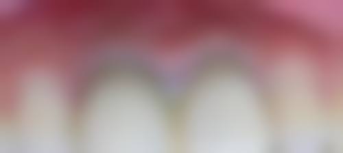 六、广东中山骑士口腔口碑如何？