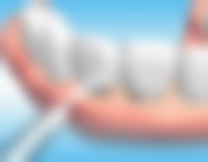 高血压不能拔牙吗 牙疼怎么办？综合评估血压情况再定，还有这些牙疼处理建议要知道！ 