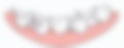 什么牌子的种植牙种植体好？欧美、日韩品牌各有千秋，需结合口腔状况、预算等综合考量！ 