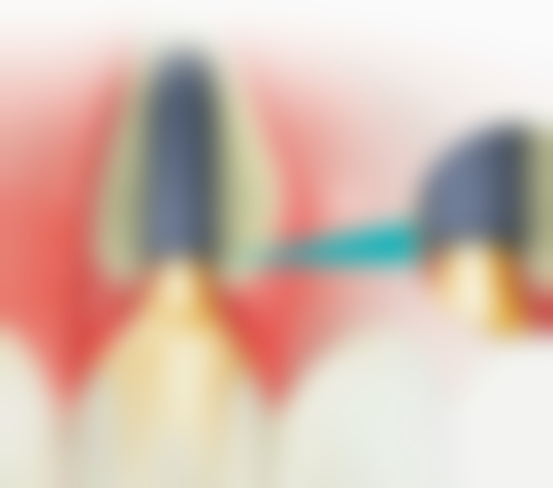 小苏打洗牙齿怎么清洗？可撒牙膏、调糊、直倒牙刷、与维C混合，还需注意频率和适用人群！ 