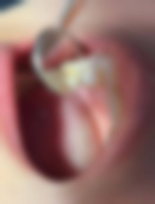 六、张家界慈利饶雷口腔诊所口碑如何？