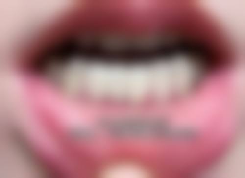 四、水墨雅德嘉口腔医院特色项目