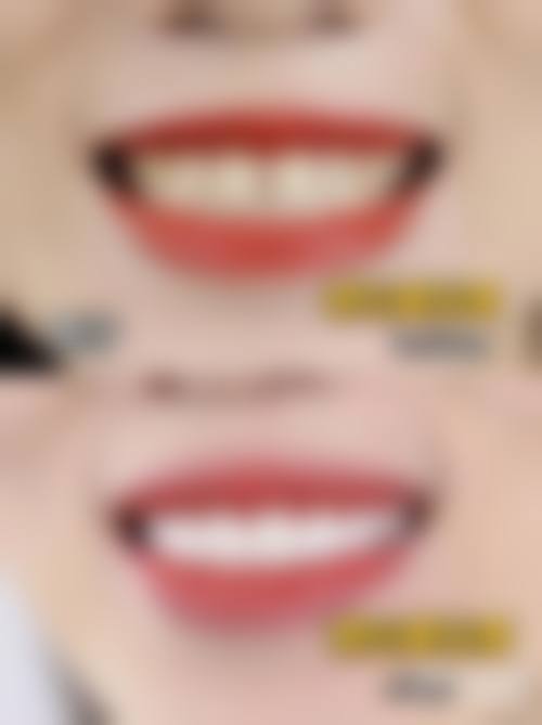 八、金华永康尚齿口腔怎么预约？