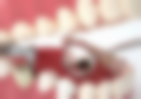 35岁以后还可以做牙齿矫正吗？可以，但与青少年有差异，这些要点助你安全矫正！ 