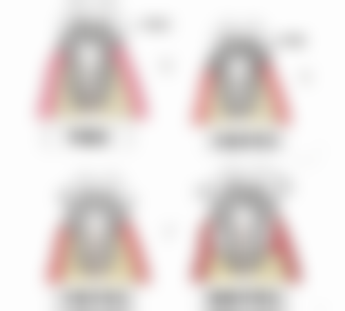 根管治疗要拔牙髓吗？答案是肯定的，需清除感染牙髓，可采用失活或拔髓两种方法 