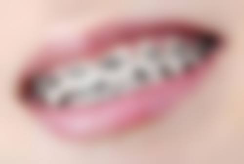 六、昆明美伊莱口腔门诊口碑如何？