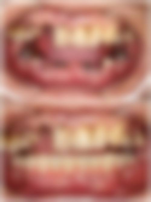 四、江苏淮安涟水碧清口腔特色项目