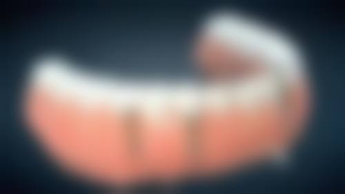 四、重庆泊菲特口腔(渝北店)特色项目