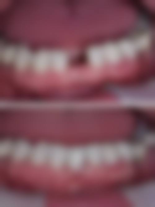 三、重庆泊菲特口腔(渝北店)医生介绍