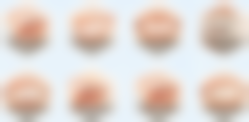 牙结石发炎能洗牙吗？轻度炎症通常能洗，重度及特殊炎症需谨慎，要听医生建议！ 