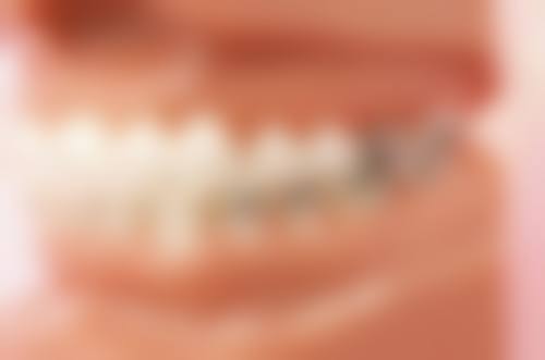 补牙是口腔种植科吗？其实补牙多在牙体牙髓科或口腔内科，种植科主要负责牙齿种植！ 