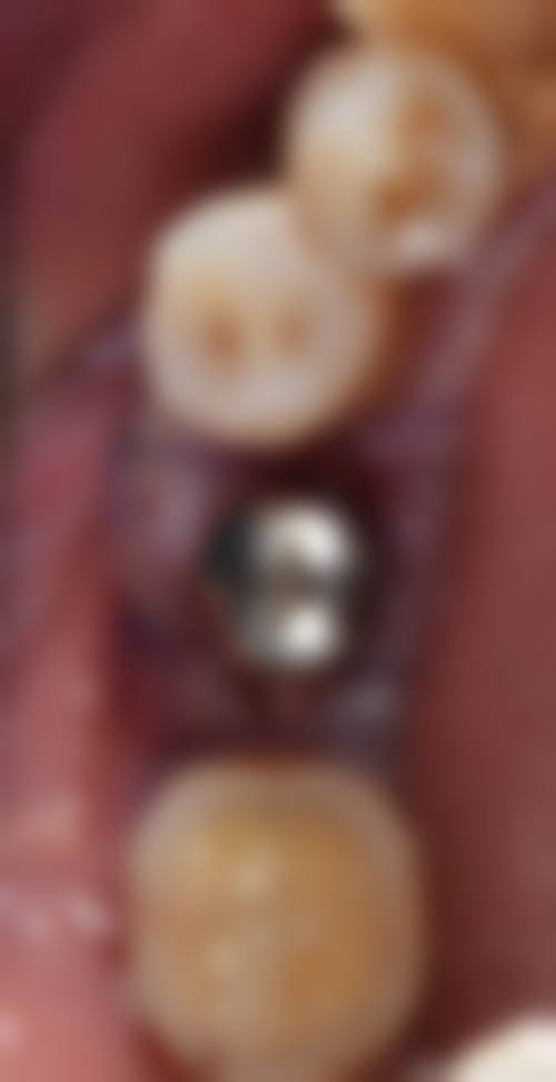 五、玉林蓝天口腔(博白店)收费价格表