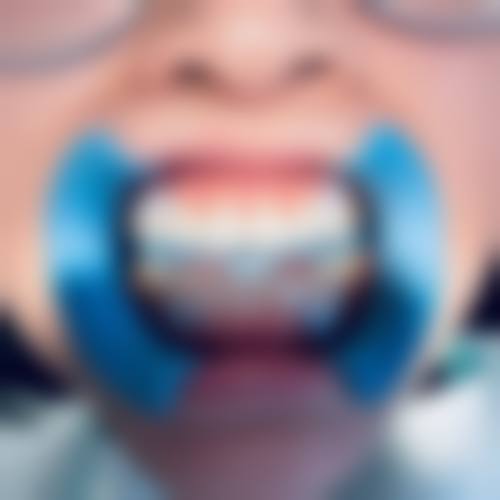 四、温州龙港笑美口腔特色项目