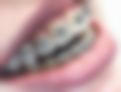 六、四川内江牙博士口腔口碑如何？