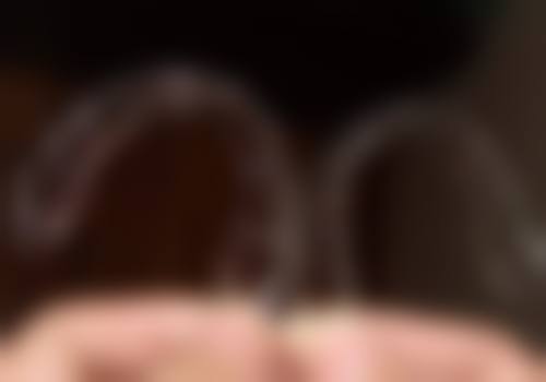 五、汕头庞传强口腔科诊所·爱怡齿科收费价格表