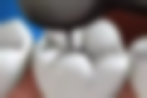 五、成都双流华颐口腔诊所收费价格表