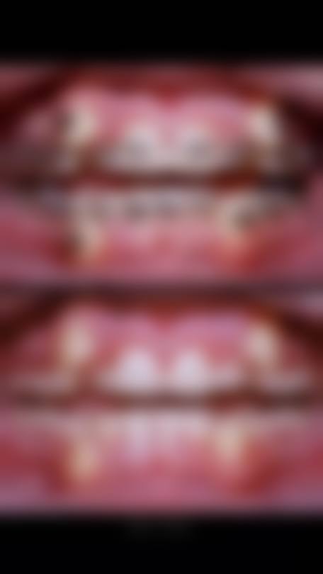 五、上海纽赛医疗整形美容门诊部口腔科收费价格表