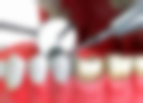 六、北京雅仕口腔诊所口碑如何？