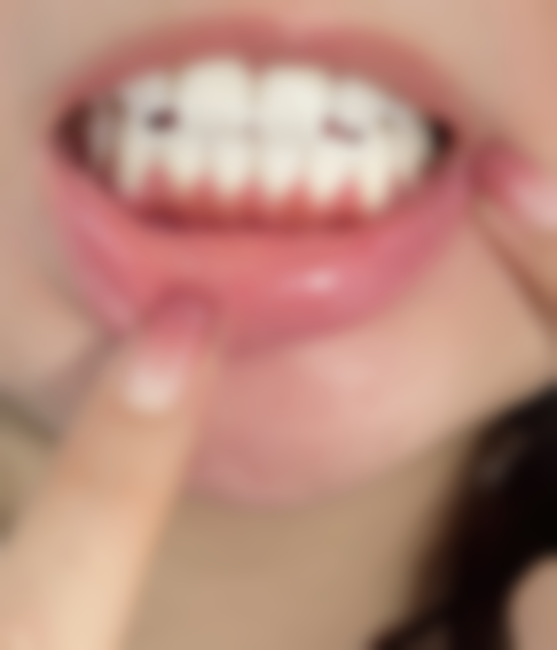 北京京大博爱口腔门诊部隐适美齿玥牙齿矫正数字化诊疗优势