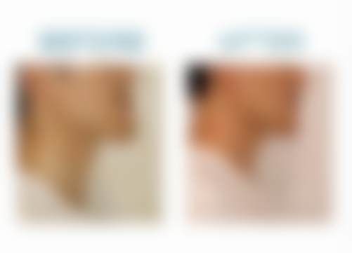 六、北京禾禾口腔周子奇医生口碑评价及真人实例反馈