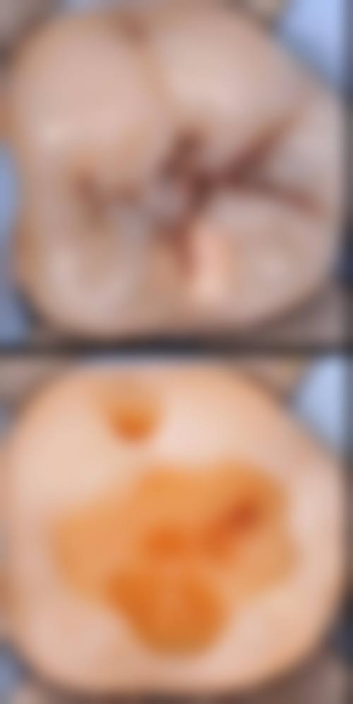 五、长江航运总医院口腔科收费价格表