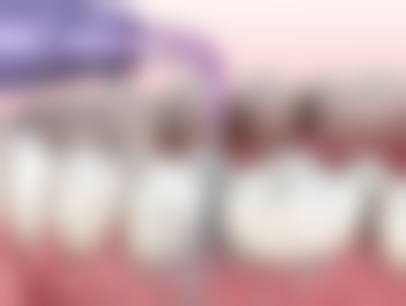 影响牙齿消炎后拔牙时间的其他因素