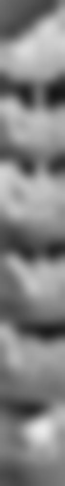 四、新余牙典口腔门诊部特色项目