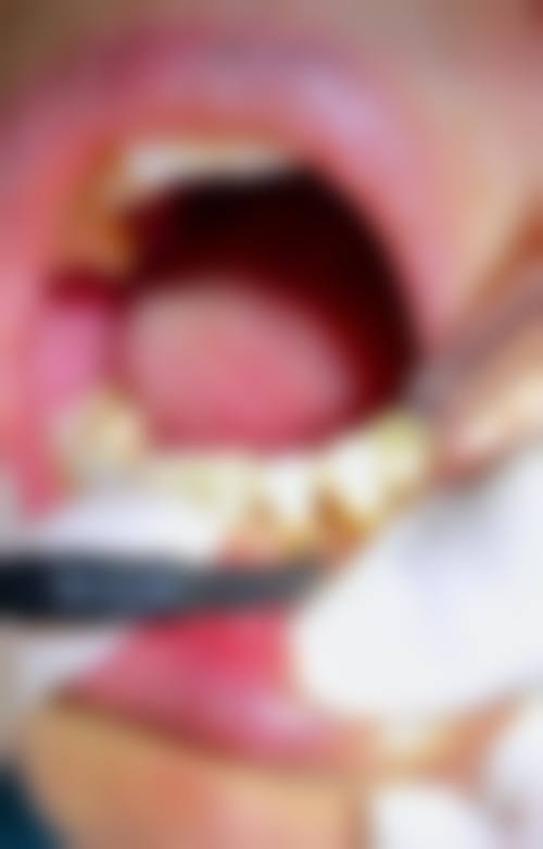 八、宁波徐茂口腔诊所怎么预约？