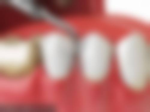 五、淄博齿倍佳口腔诊所收费价格表