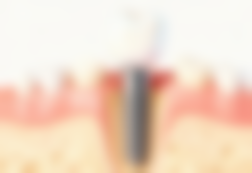 五、宁波徐茂口腔诊所收费价格表