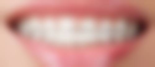 二、厦门嚼力口腔(钟林)王嘉俊医生擅长项目