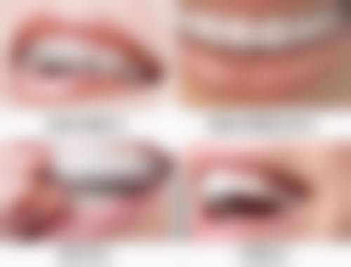 七、昆山萌牙客口腔刘亚医生怎么预约？